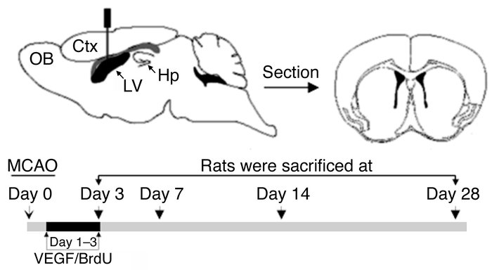 Scheme for quantifying postischemic neurogenesis in the rat brain. MCAO ...