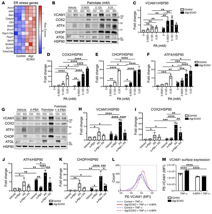 Loss of endothelial-specific ATGL leads to ER stress–induced inflammatio...