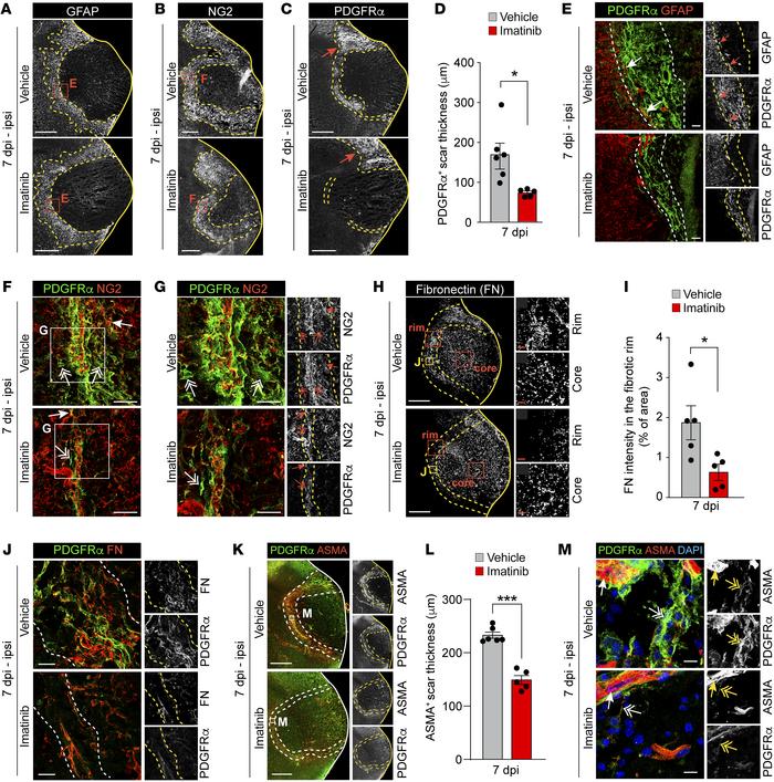 Imatinib specifically targets expansion of a PDGFRα+ myofibroblast scar ...