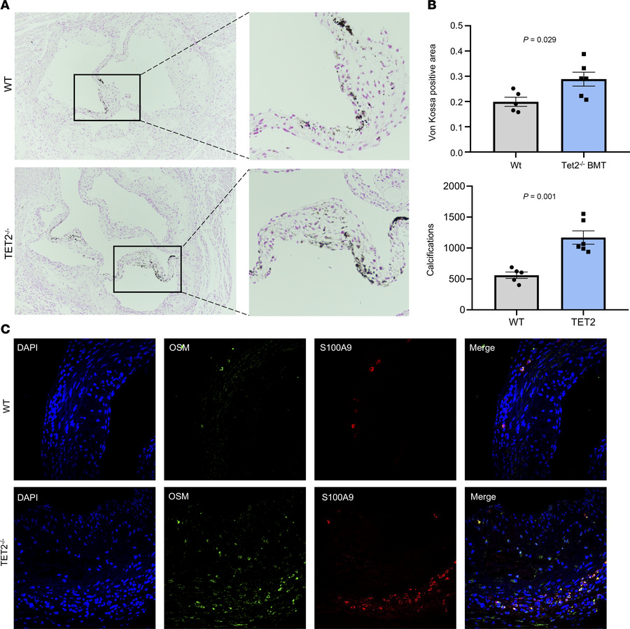 TET2-mutant BMT accelerates aortic valve calcification.
(A) Von Kossa st...