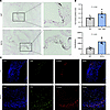 TET2-mutant BMT accelerates aortic valve calcification.