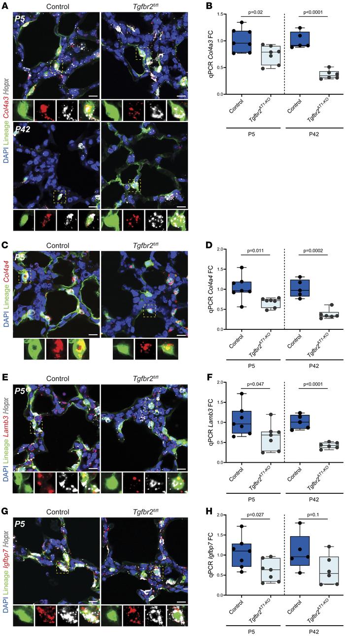 Loss of TGF-β at birth perturbs AT1-mediated matrisome expression throug...