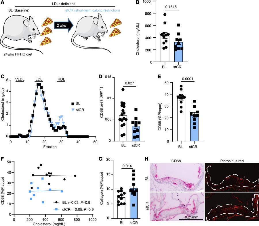 stCR induces atherosclerosis resolution.
(A) Experimental design. WT mic...