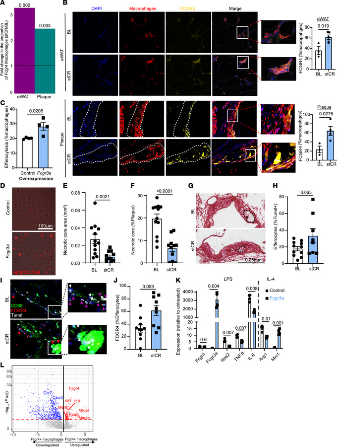 FCGR4+ macrophages accumulate with weight loss and promote a pro-reparat...