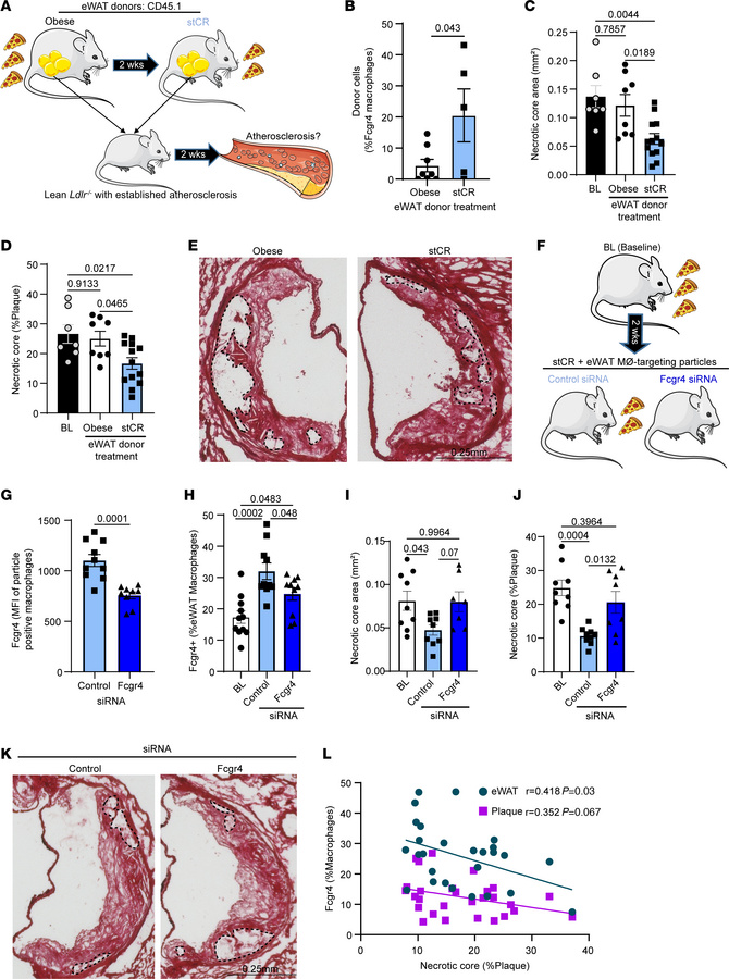eWAT-derived Fcgr4+ macrophages reduce plaque necrotic core.
(A) Schemat...
