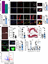 FCGR4+ macrophages accumulate with weight loss and promote a pro-reparative