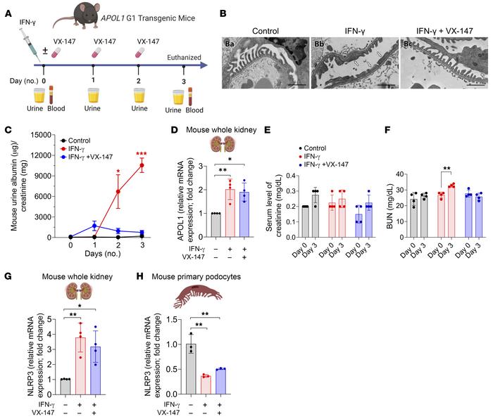 VX-147 rescues G1-induced podocyte injury and proteinuria in vivo.
(A) E...