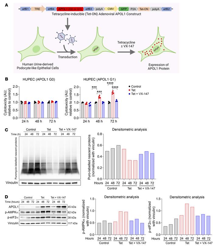 APOL1-induced podocytopathy is rescued by VX-147 in HUPECs.
(A) Schemati...