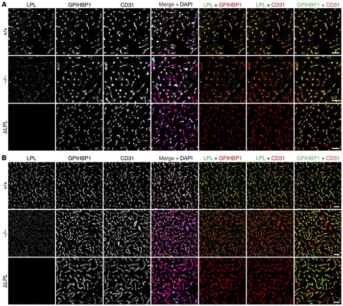 Reduced amounts of mLPL in the heart and BAT of Apoa5–/– mice.
Heart and...