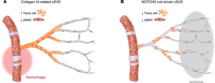 Opposite changes in mural cells in the arteriole-capillary transition zo...