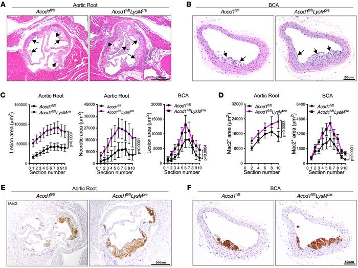 Acod1 deficiency in myeloid cells confers increased atherogenesis and ma...