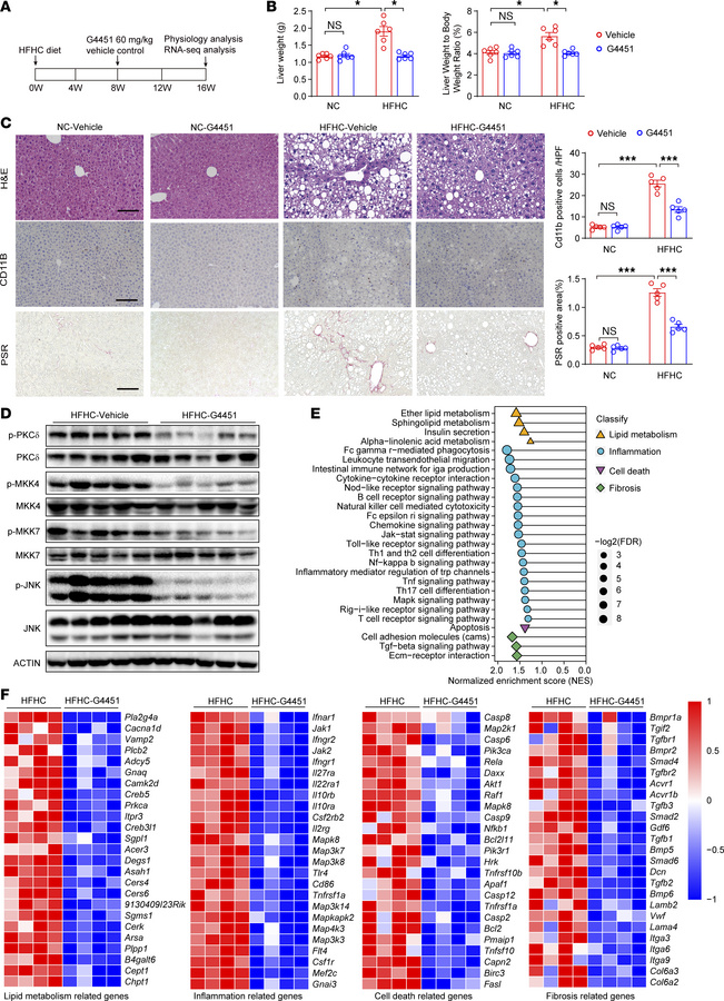 G4451 effectively blocks MASH in mice.
(A) Timeline for the experimental...
