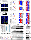 GPR31 shows pro-MASH capacity by promoting hepatocyte lipotoxicity in vitro