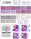 GPR31 and its glycosylation at N5 are required for MASH progression in mice