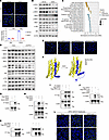 G4451 was developed as an anti-MASH candidate via blockade of the GPR31-Gαi