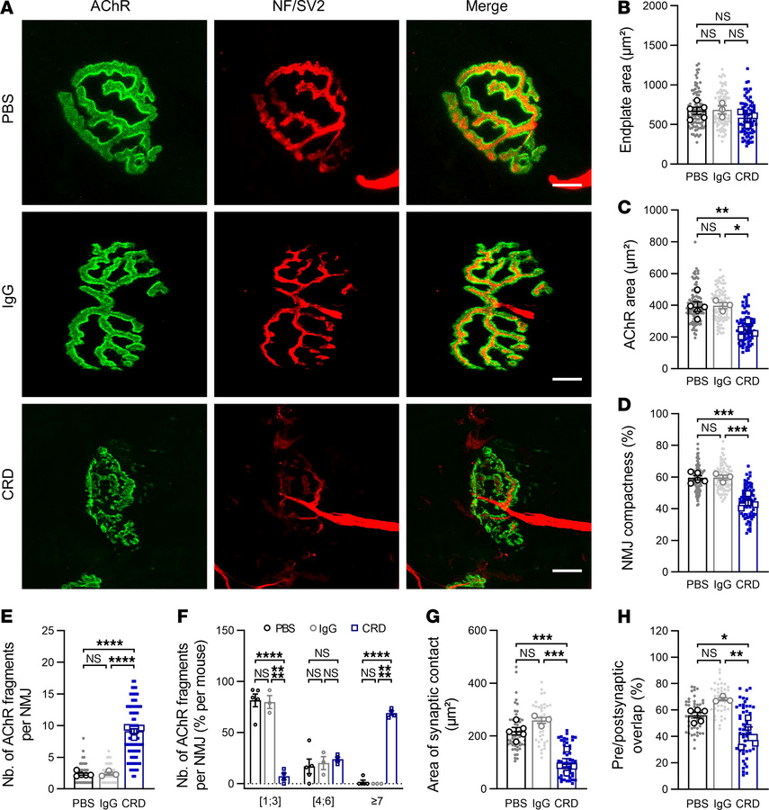 NMJ structural defects in the TA muscles of CRD mice.
(A) Representative...