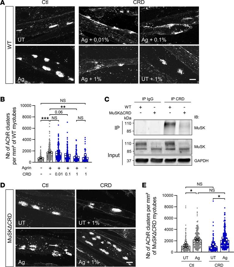 Anti-MuSKCRD antibodies specifically inhibit Agrin-induced AChR clusteri...