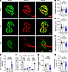 NMJ structural defects in the TA muscles of CRD mice.