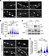 Anti-MuSKCRD antibodies specifically inhibit Agrin-induced AChR clustering