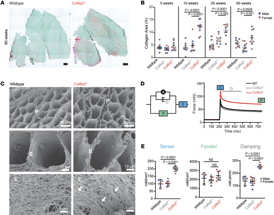 
Col6a2–/– muscle ECM is fibrotic, has abnormal morphology, and shows al...