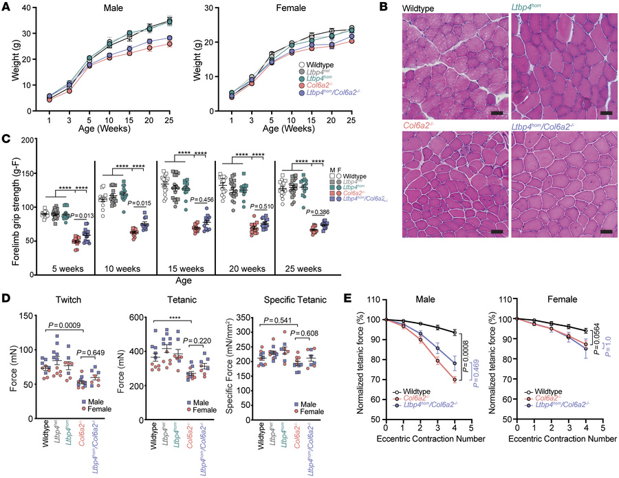 Decreased Ltbp4–TGF-β binding does not alter the Col6a2–/– mouse muscle ...