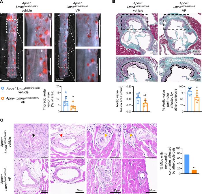 YAP/TAZ inhibition with verteporfin attenuates atherosclerosis burden in...