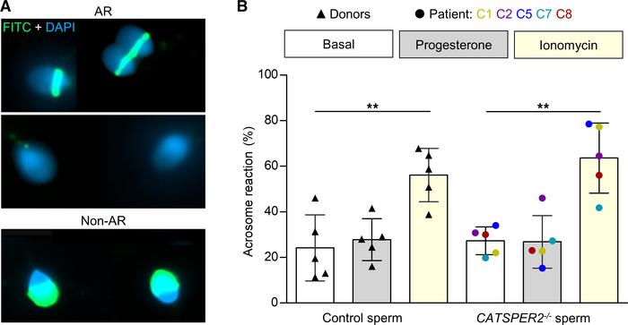 Acrosome reaction of control and CATSPER2–/– sperm.
(A) Representative f...