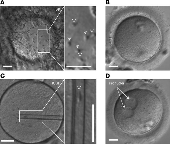 Microscopic documentation of medically assisted reproduction with CATSPE...