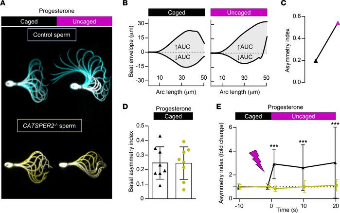 Progesterone-induced changes in flagellar beat asymmetry of control and ...