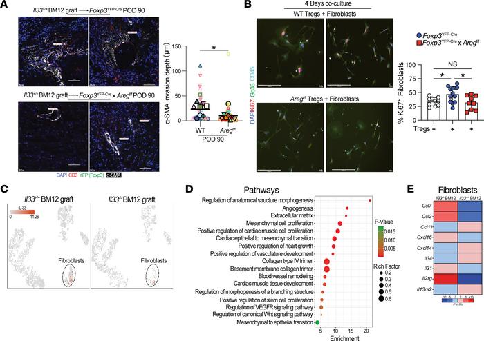 Treg-secreted Areg increases fibroblast proliferation.
(A) Representativ...
