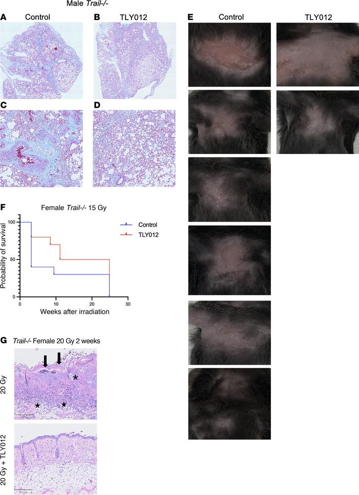 Rescue from long-term effects of radiation pneumonitis and radiation der...
