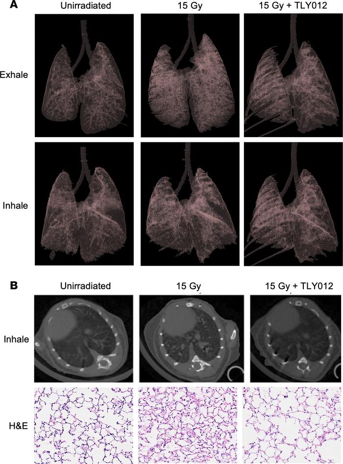Respiration-gated imaging in mice irradiated with a whole-thorax x-ray i...