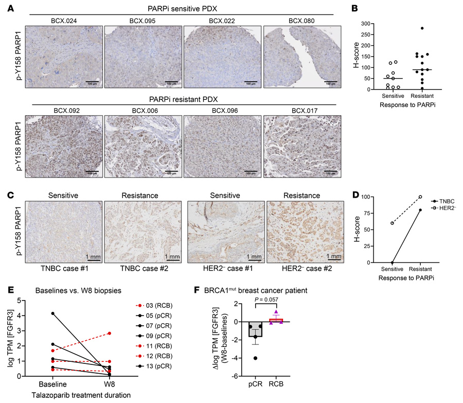 p-Y158 PARP1 is detectable in TNBC patient tumors and PDX models with ta...