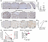 p-Y158 PARP1 is detectable in TNBC patient tumors and PDX models with talaz