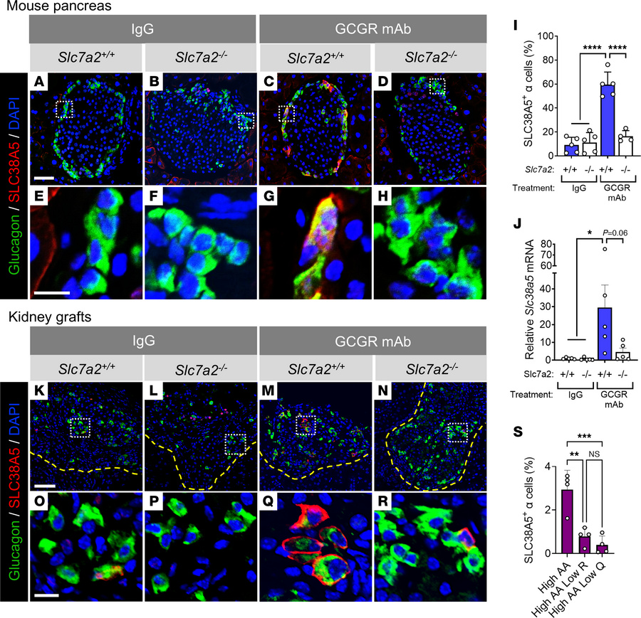 SLC7A2 is required for upregulation of Slc38a5 expression during interru...