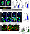 SLC7A2 is required for α cell proliferation in response to interrupted gluc