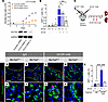 SLC7A2-dependent stimulated α cell proliferation is islet autonomous.