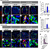 SLC7A2 is required for upregulation of Slc38a5 expression during interrupte