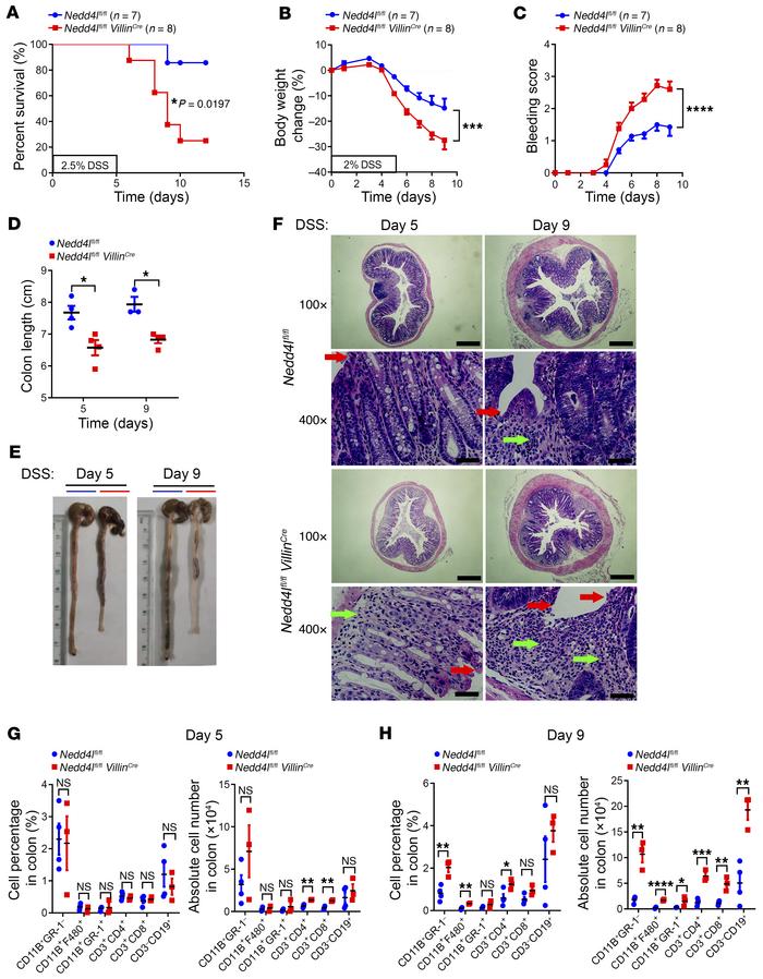 
Nedd4l deficiency in IECs promotes DSS-induced colitis in mice.
(A) Ned...