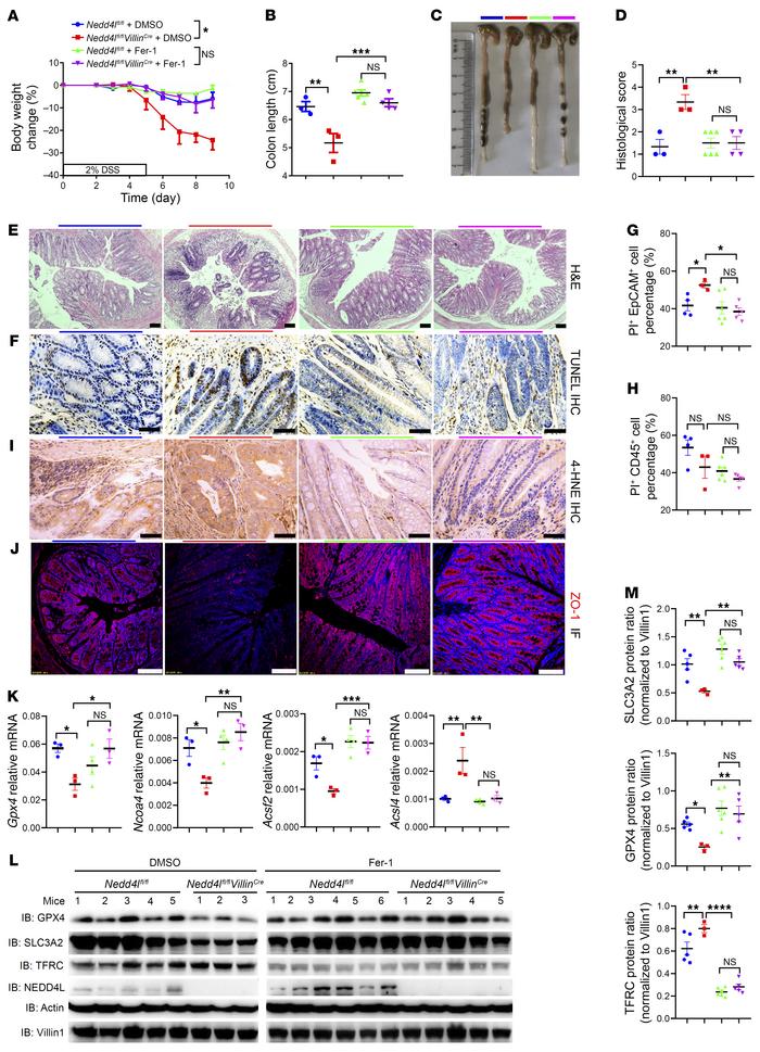 NEDD4L regulates DSS-induced colitis through ferroptosis.
Nedd4lfl/fl Vi...