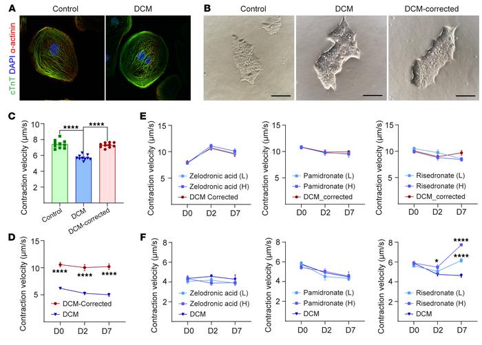 Risedronate corrects ΔK210 hiPSC-derived cardiomyocyte contraction.
(A) ...
