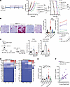 TAM depletion suppresses late hypoxia and angiogenic compensation and resto