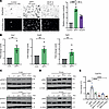Extracellular osteopontin reprograms macrophages through CD44/integrin B3-l