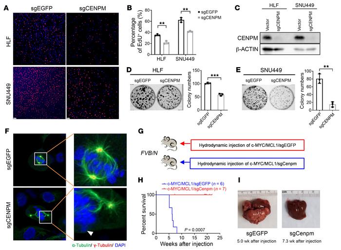 Targeting CENPM suppresses HCC cell proliferation and c-MYC–induced hepa...