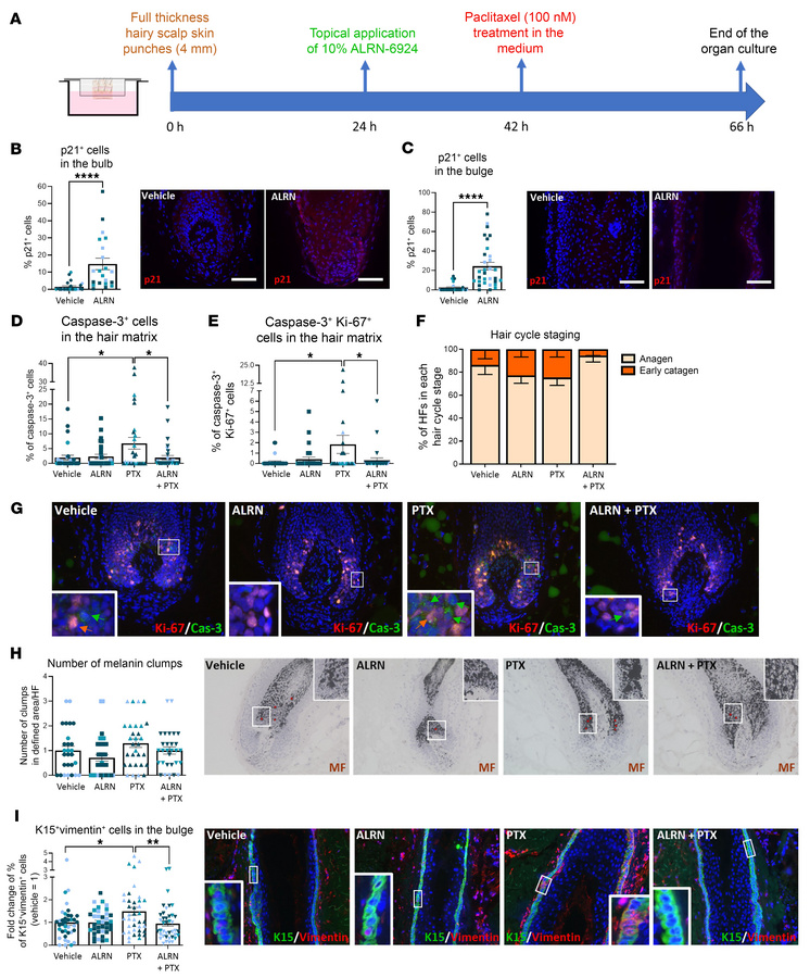 Topically applied ALRN-6924 promotes dystrophic anagen and protects huma...