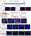 ALRN-6924 promotes dystrophic anagen and protects human HF from PTX-induced