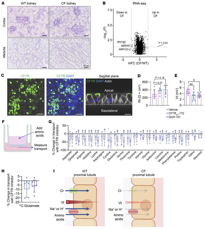 Inhibition of CFTR in cultured human renal proximal tubule epithelia imp...