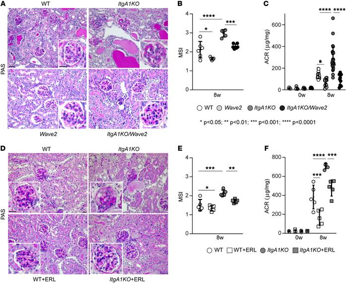 EGFR contributes to ADR-induced glomerular injury.
(A) Representative im...