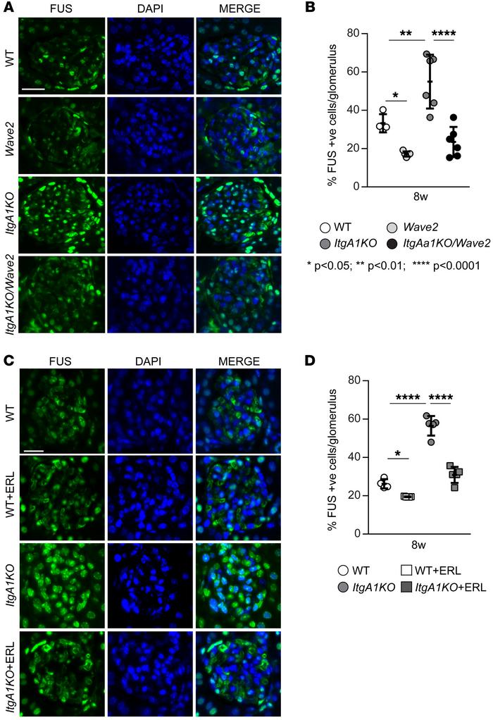 EGFR contributes to nuclear FUS translocation in ADR-induced injury.
(A ...