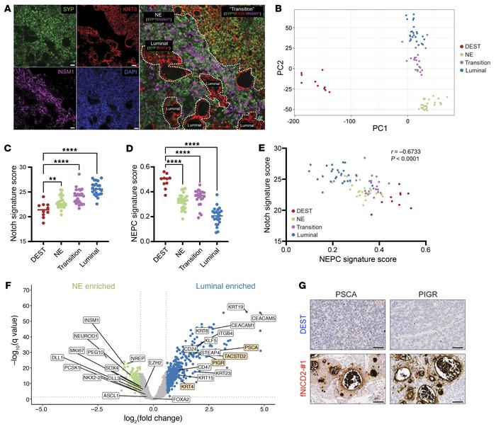 Notch signaling induces distinct lineages in human NEPC models.
(A) Immu...